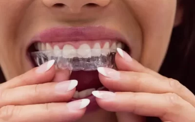 Invisalign Garden Grove: Clear Aligner Therapy for Discreet Orthodontic Correction